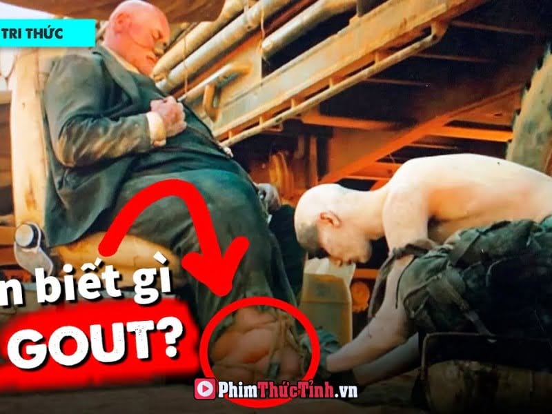 Vì Sao Càng Giàu Càng Dễ Bị Gout?