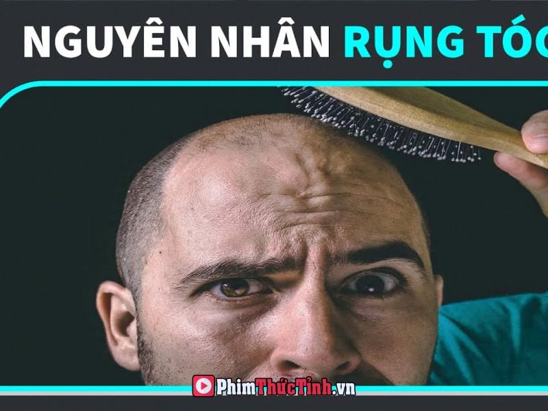 Hói Đầu Có Nguy Hiểm?